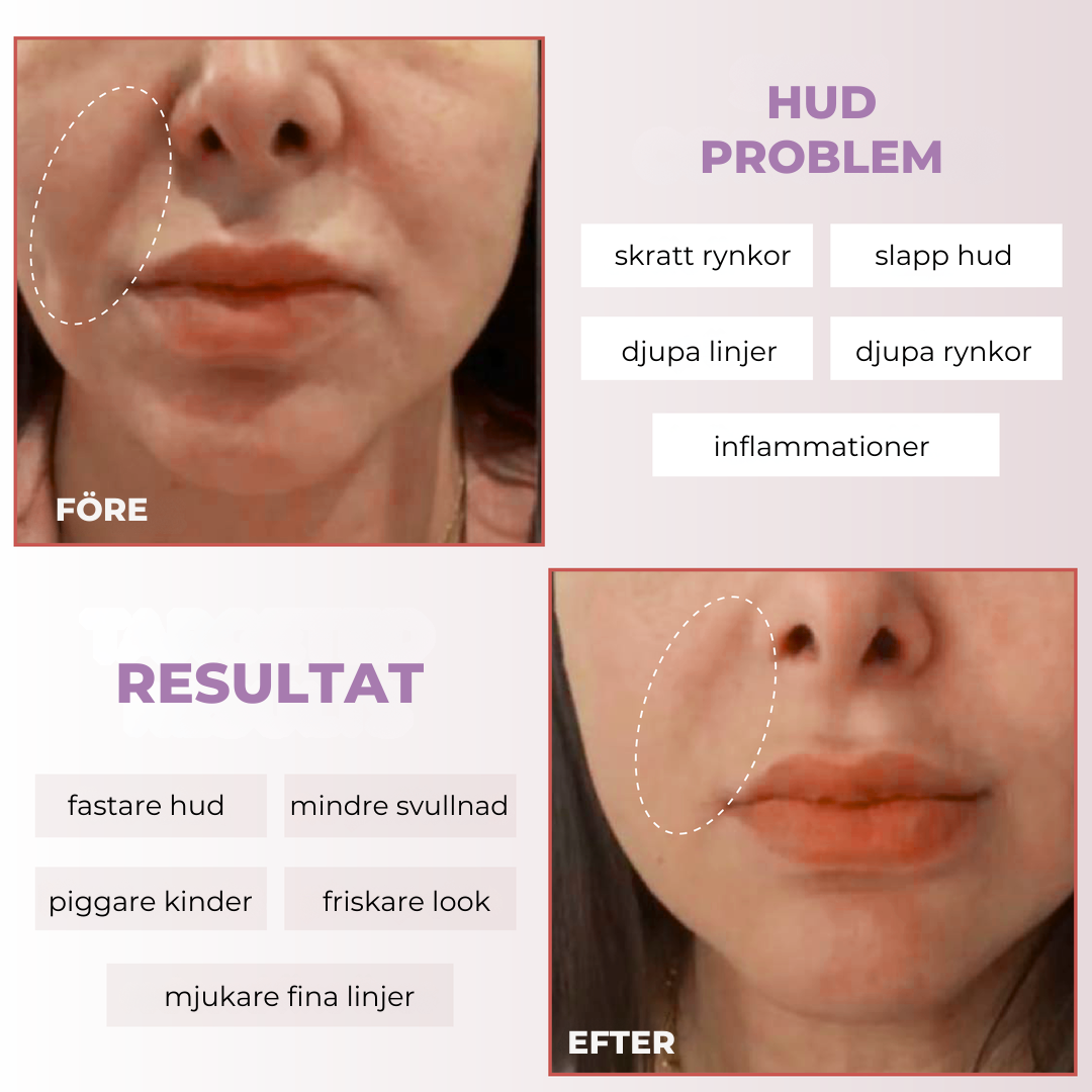 Contoura™ - Få tillbaka ditt naturliga glow direkt hemifrån