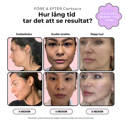 Contoura™ - Få tillbaka ditt naturliga glow direkt hemifrån